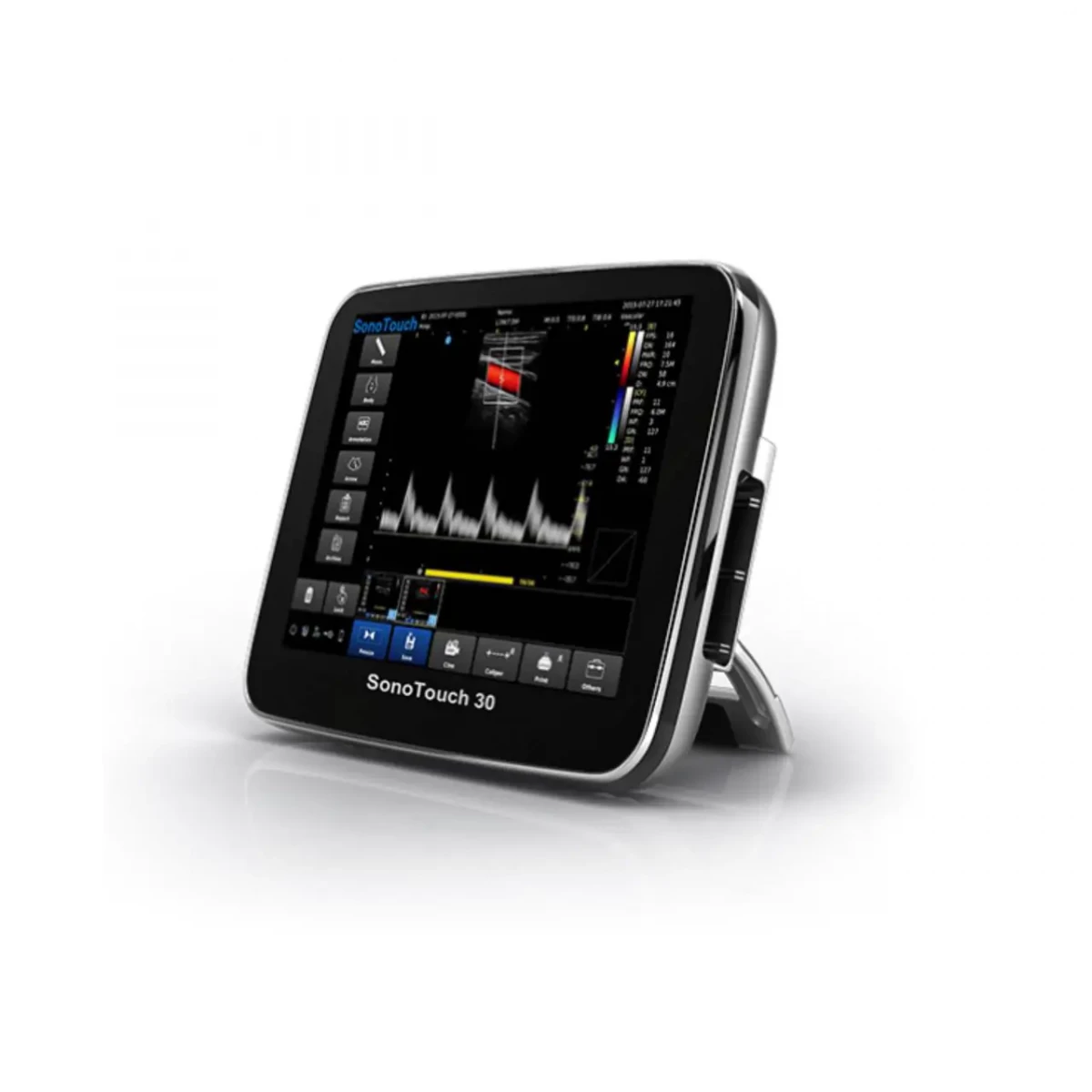УЗИ аппарат CHISON SonoTouch 30 (ECO 3)