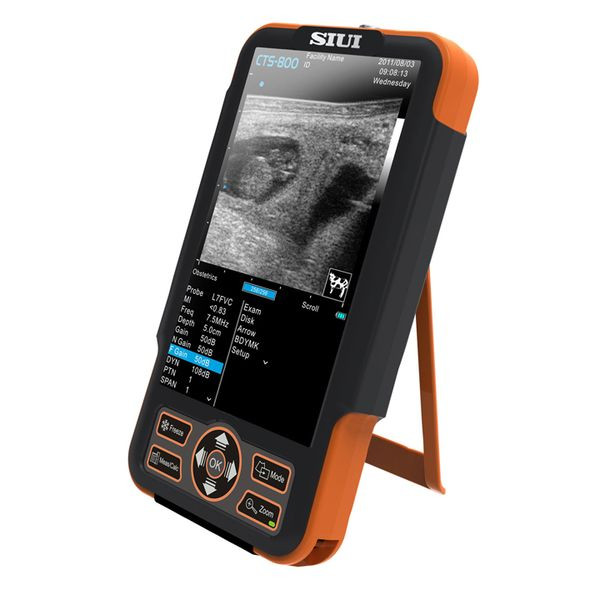 Ветеринарный УЗИ сканер SIUI CTS-800